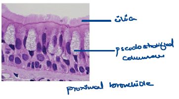 Respiratory epithelium where Mycoplasma attaches