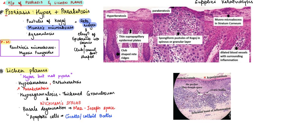 Histology comparison of Psoriasis vs Lichen Planus