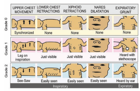 Pediatric Respiratory Distress Scoring System