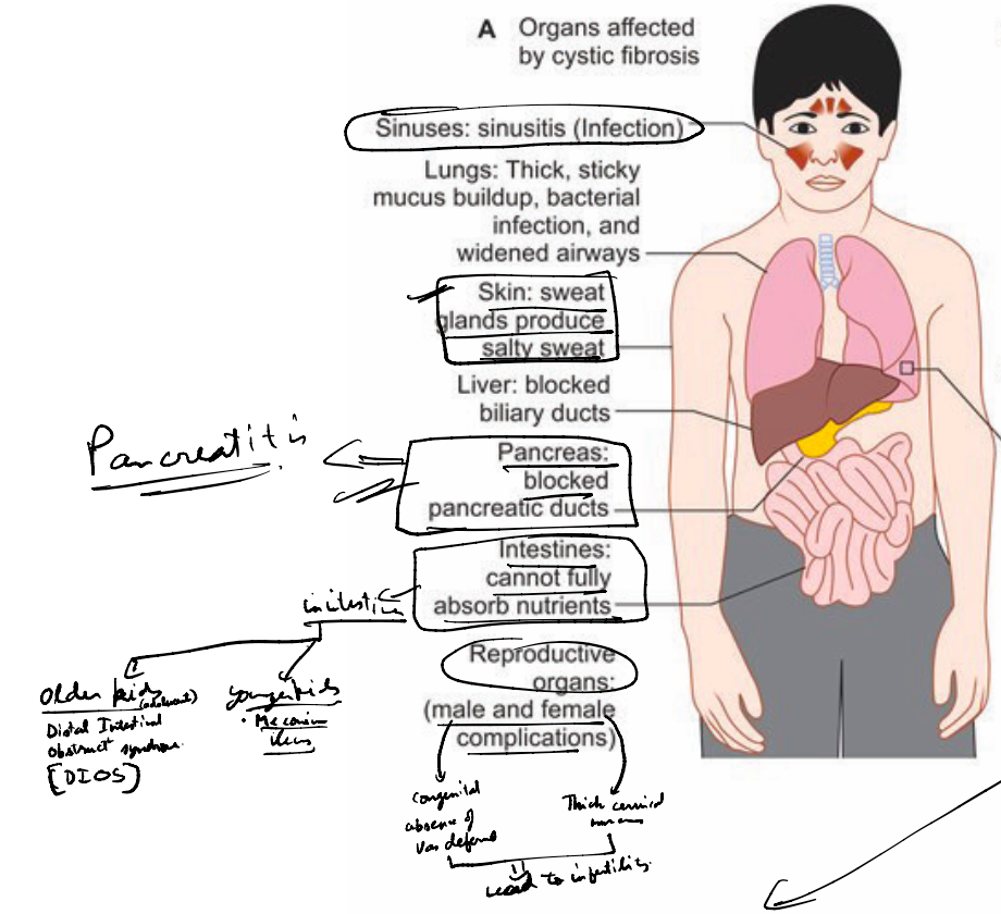 Cystic Fibrosis Systemic Effects