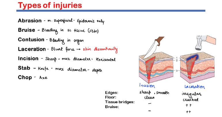 Comparison of different wound types including abrasion, bruise, laceration, incision, stab, and chop wounds