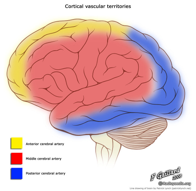 Lateral view of the brain showing the vascular territories of the ACA, MCA, and PCA