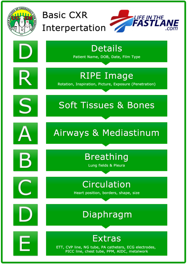 Systematic approach to CXR interpretation using the DRS ABCDE mnemonic