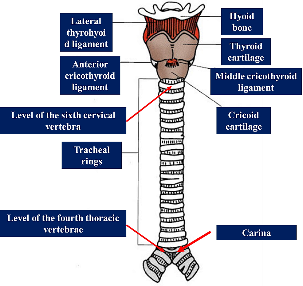 Trachea, Carina, and Bronchi Diagram
