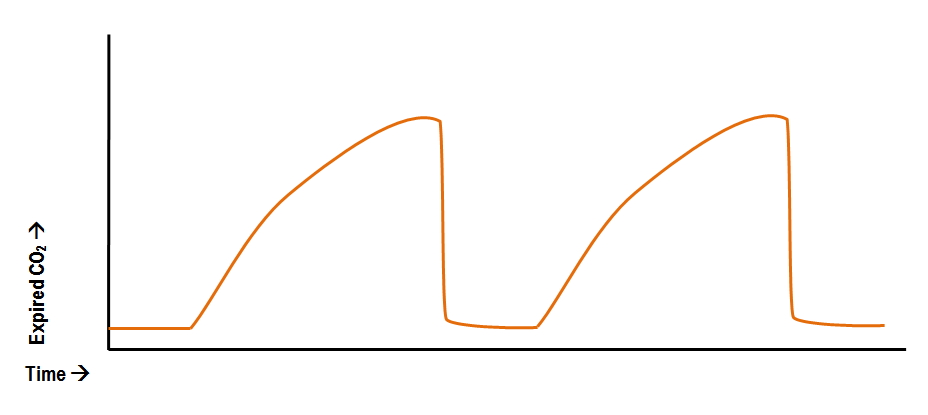 Normal Capnogram Waveform Capnography | Anesthetic Equipment and Monitoring - OnCourse NEET-PG