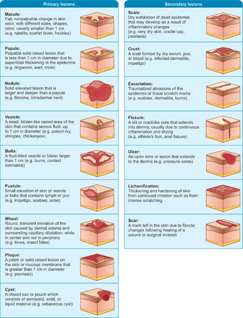 Dermatologic lesions diagram showing primary and secondary skin lesions