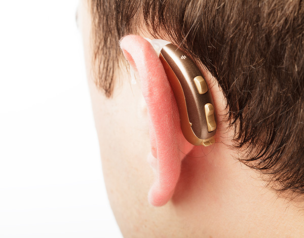 Behind-the-ear (BTE) hearing aid