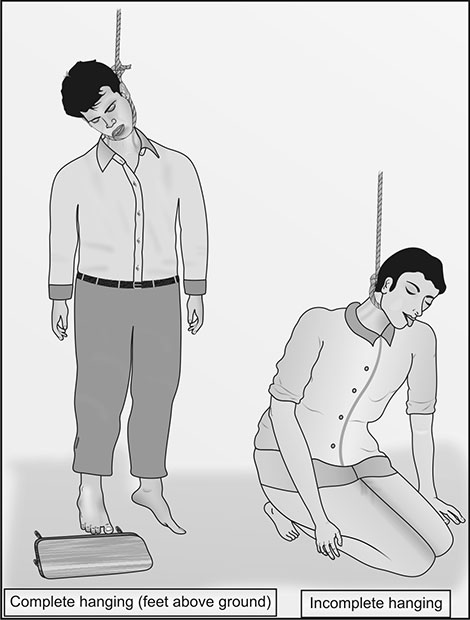 Complete vs Incomplete Hanging