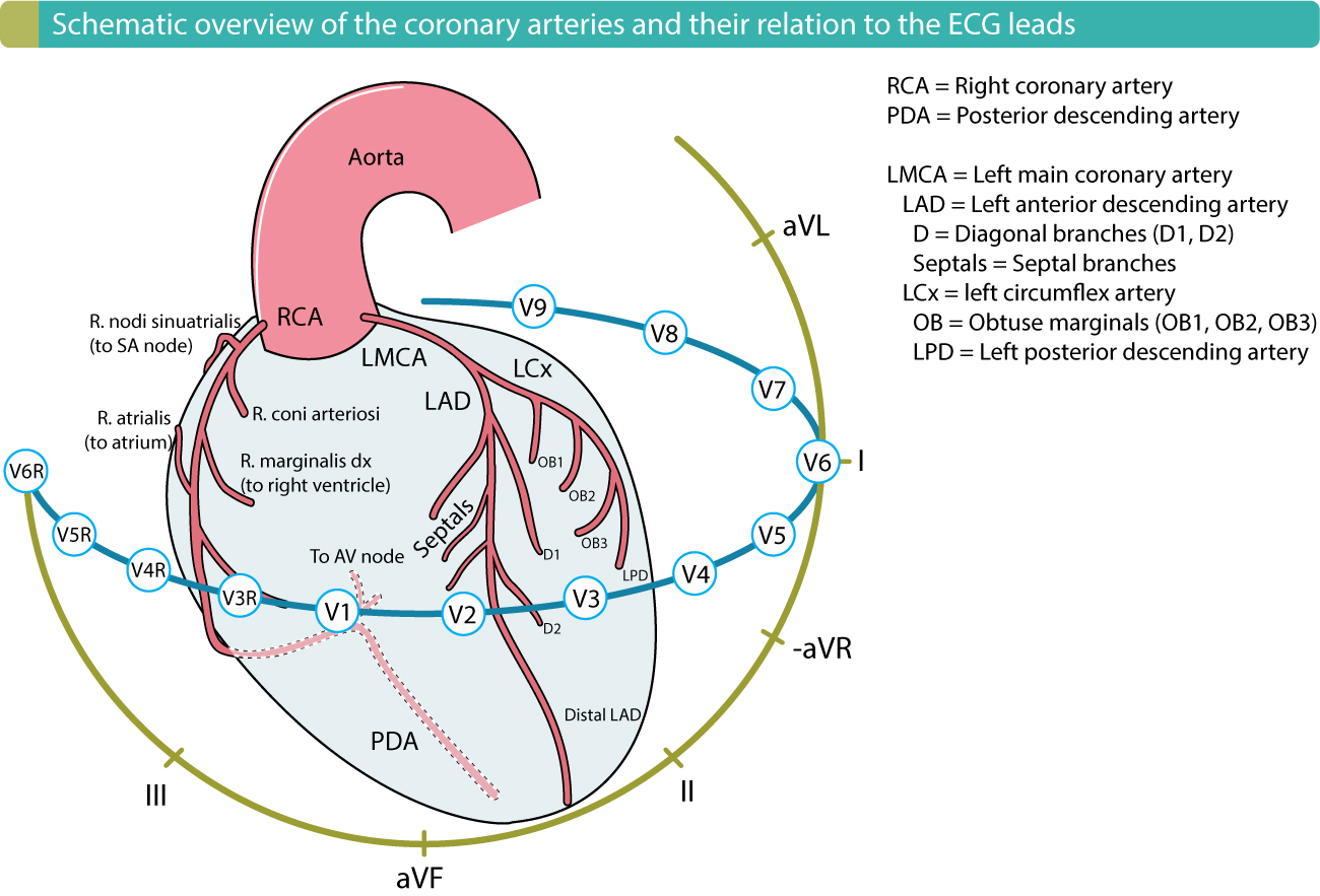 Coronary Anatomy and ECG Lead Correlation
