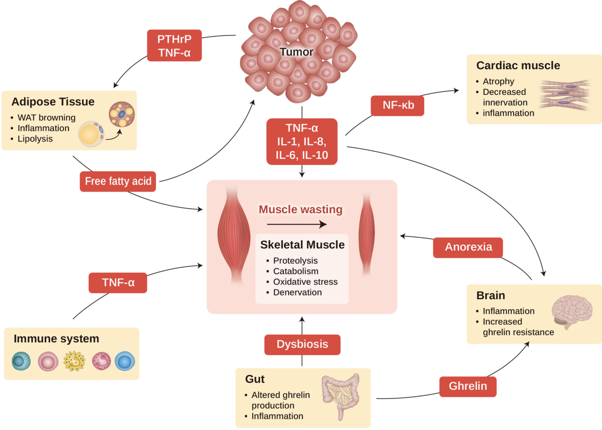 Weight Loss and Cachexia | Clinical Manifestations and Presentation of ...