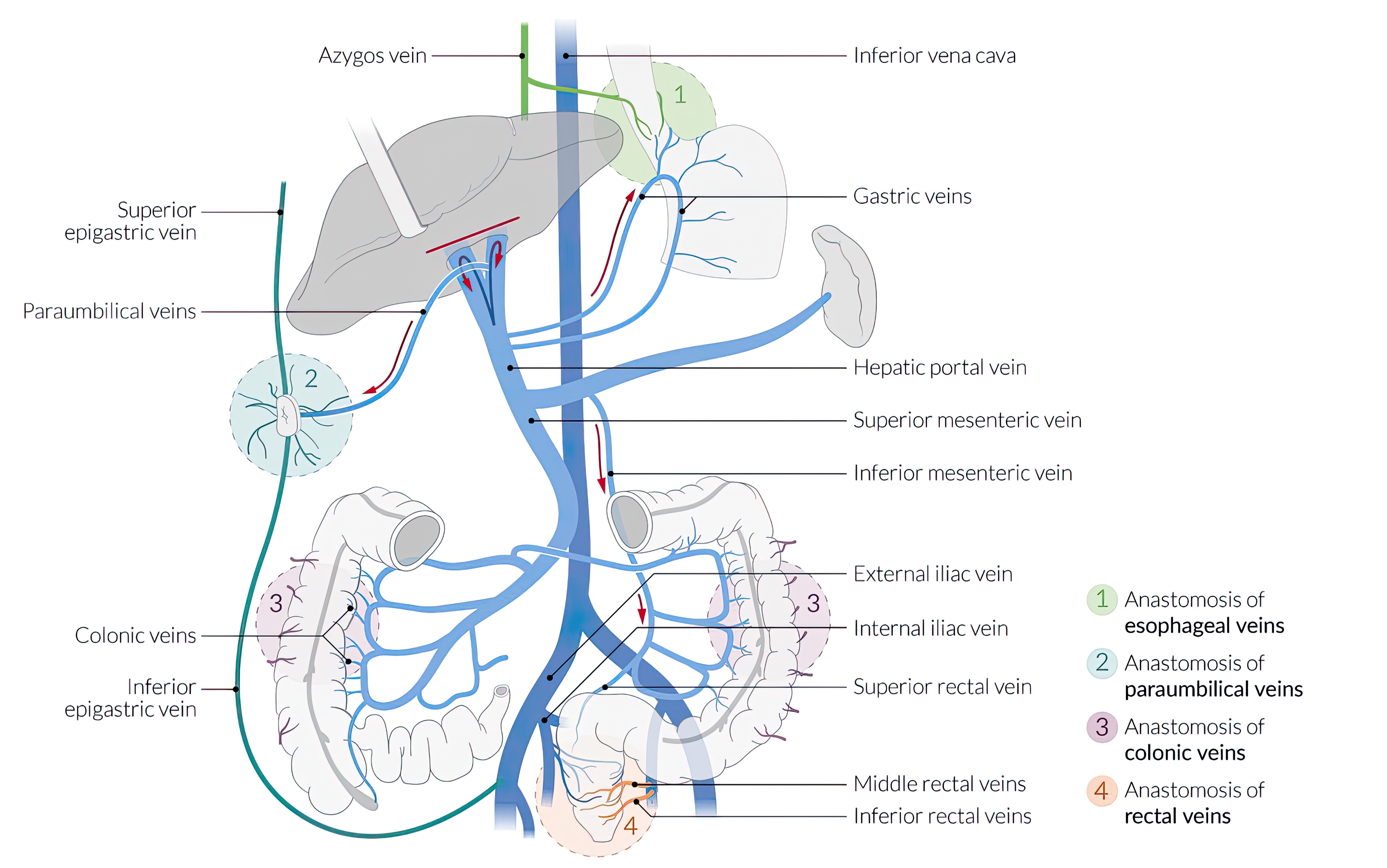 Portosystemic anastomoses in portal hypertension