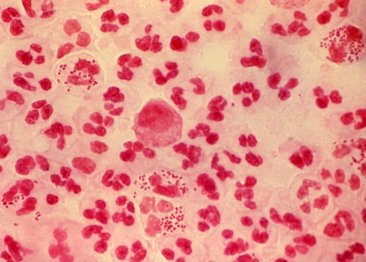 Image for question 351