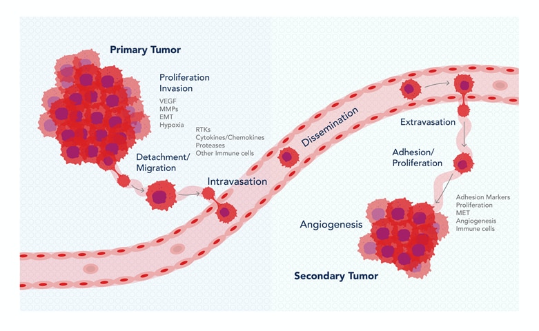 Metastatic cascade steps diagram