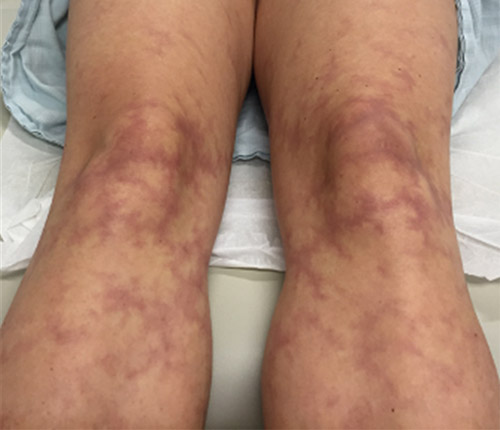 Image for question 549