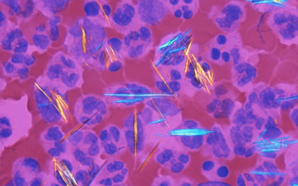 Image for question 145