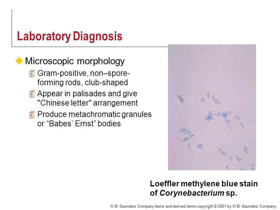 Corynebacterium sp. Loeffler methylene blue stain