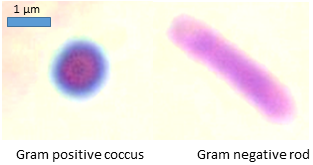 Gram stain: Gram-positive cocci & Gram-negative bacilli