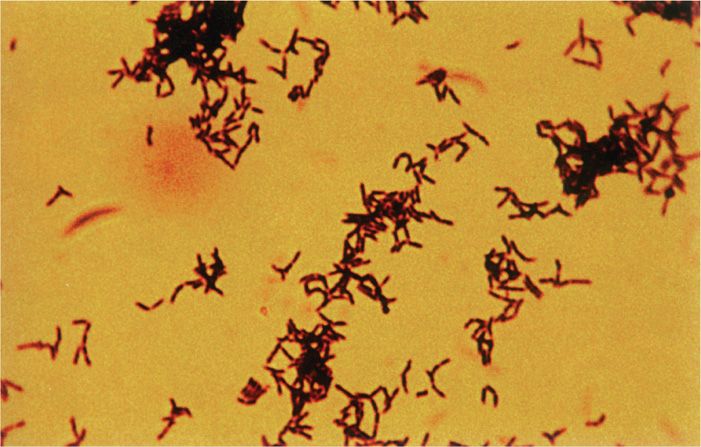 Actinomyces and Nocardia | Gram-positive - OnCourse NEET-PG