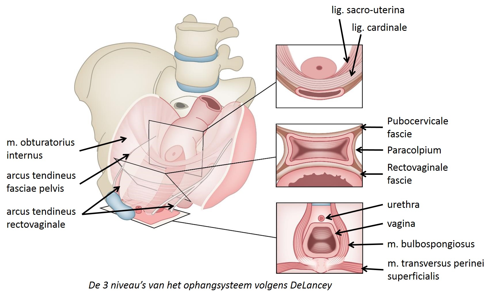 DeLancey's 3 levels of vaginal support