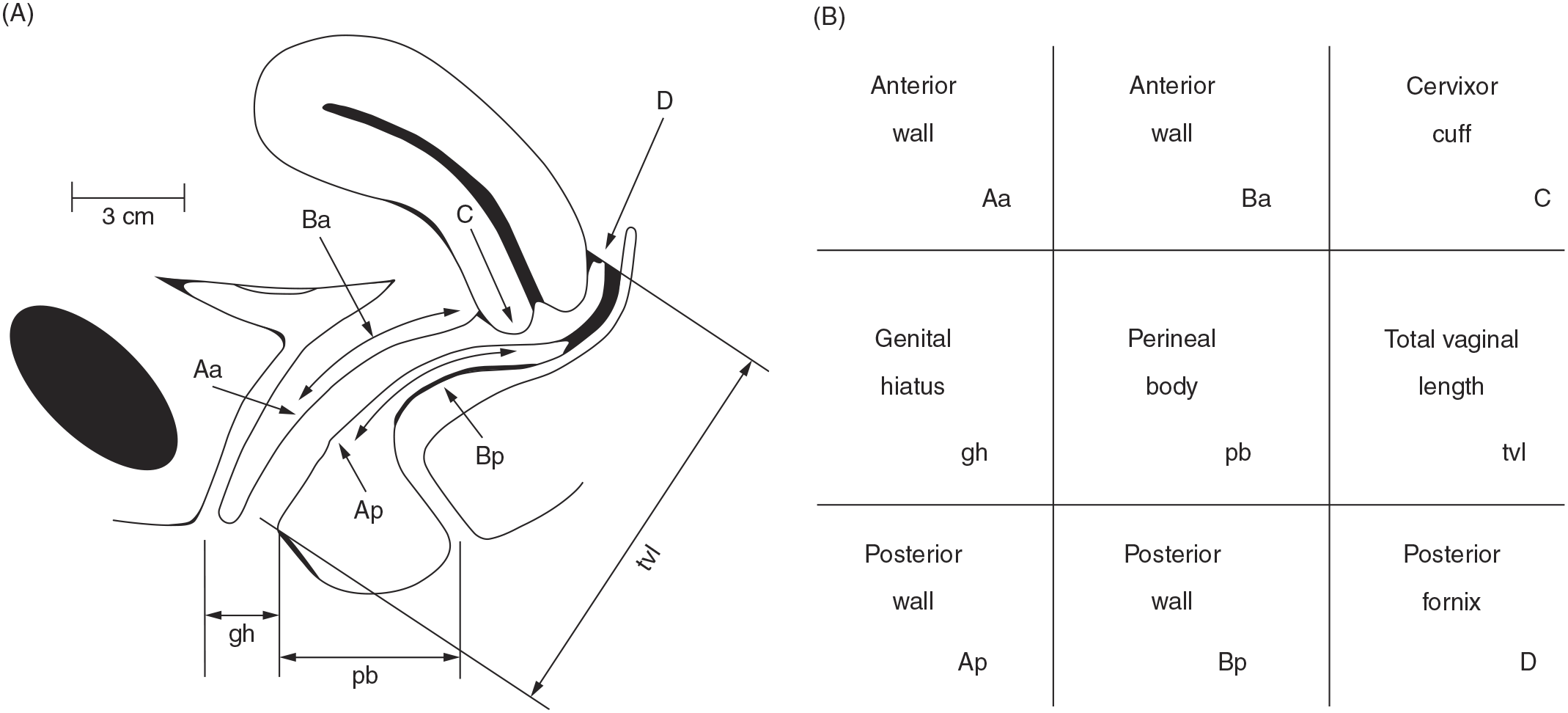 Pelvic Organ Prolapse: Classific... - Free Indian Medical PG