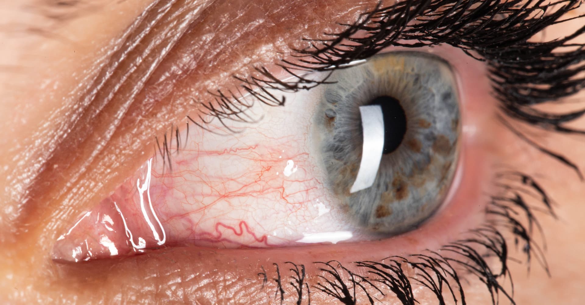 Image for question 248