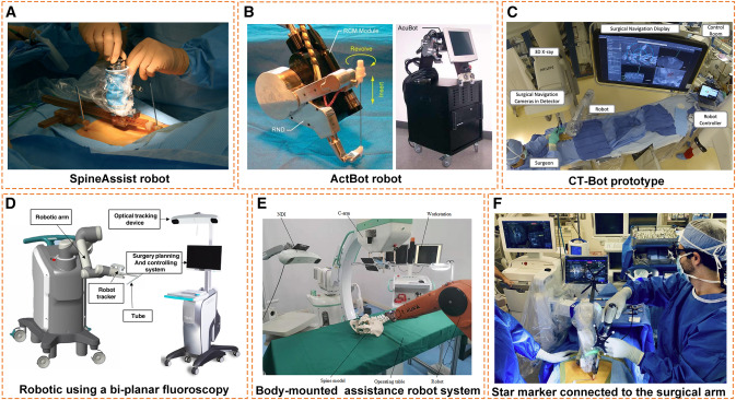 Computer-Assisted Spine Surgery | Computer-Assisted Surgery - OnCourse ...