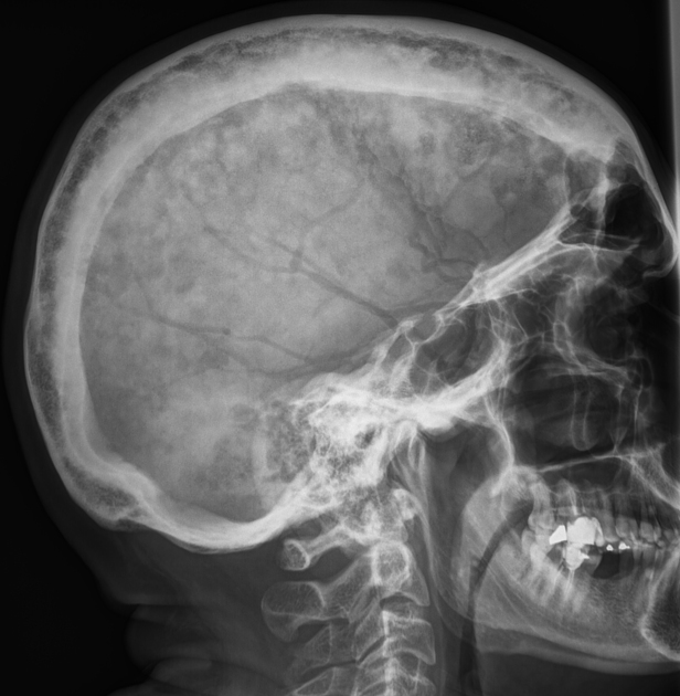 Image for question 70