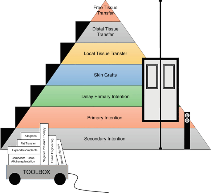 Reconstructive Ladder/Elevator for Soft Tissue Coverage
