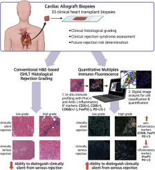 Cardiac Allograft Biopsy Evaluation Methods