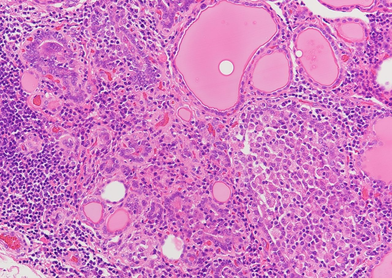 Image for question 82