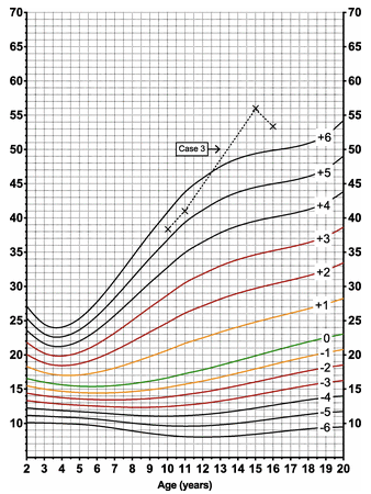 Growth Charts and Monitoring | Growth and Development - OnCourse NEET-PG