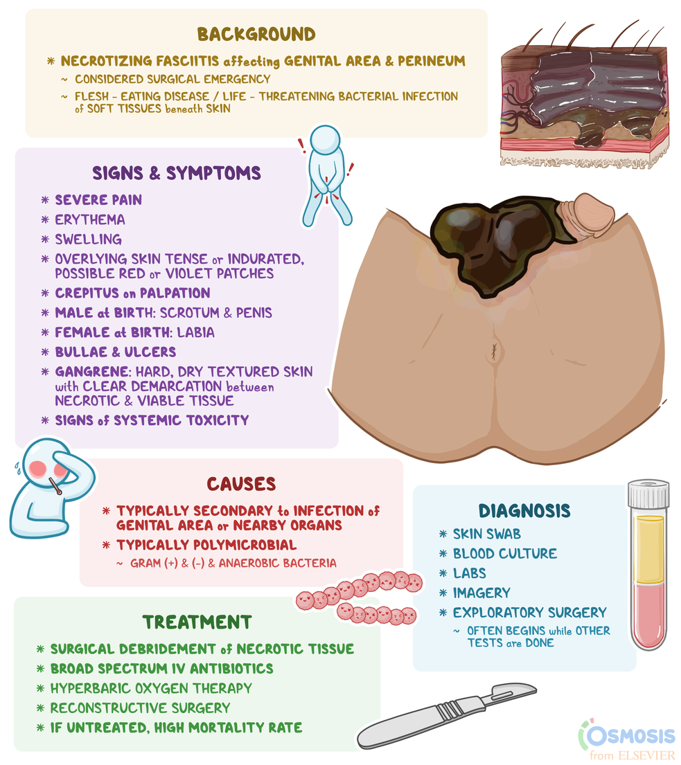 Fournier’s Gangrene: Background, Signs, Causes, Treatment