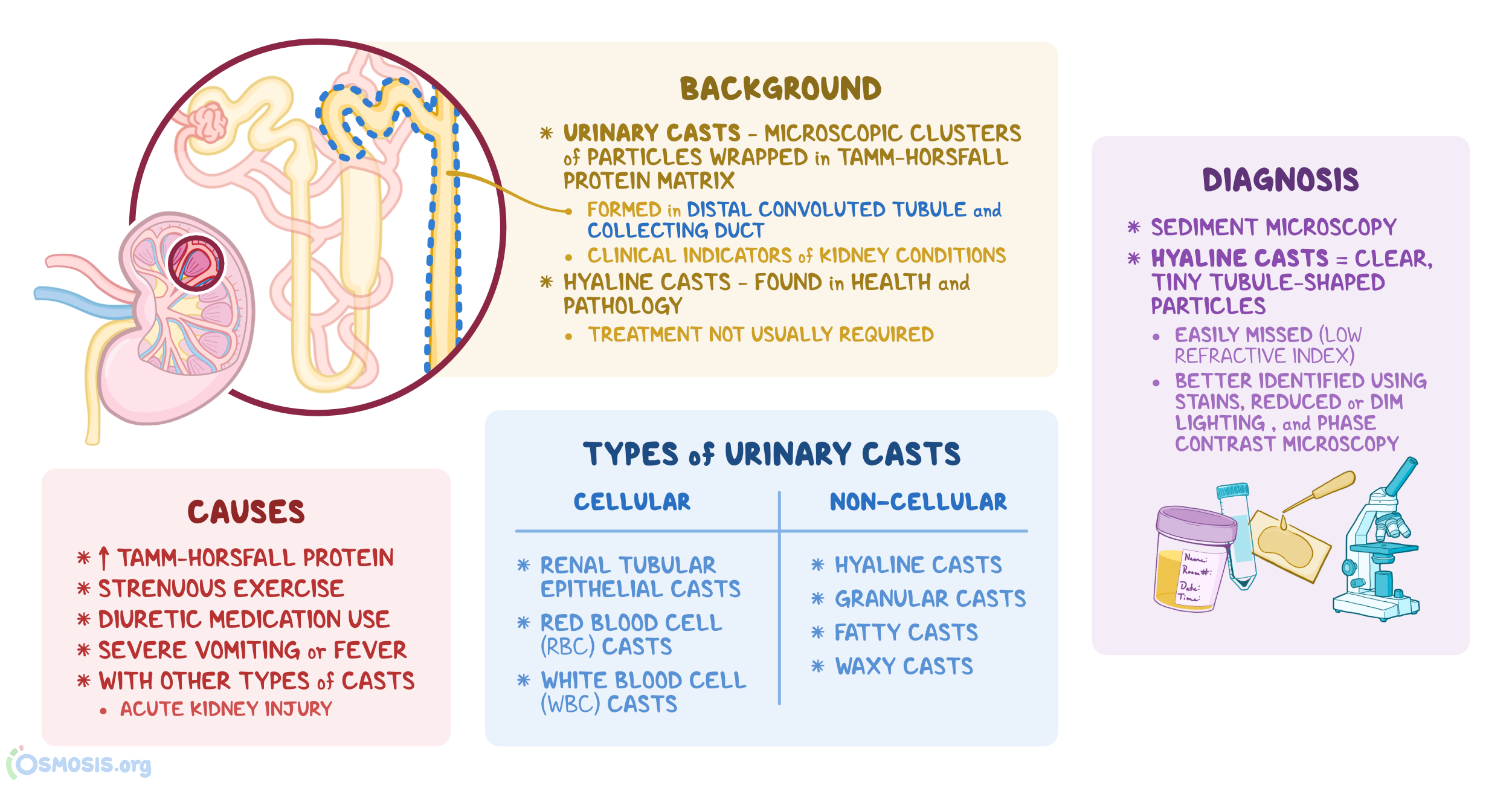 Urinary Casts: Types, Causes, Background, and Diagnosis