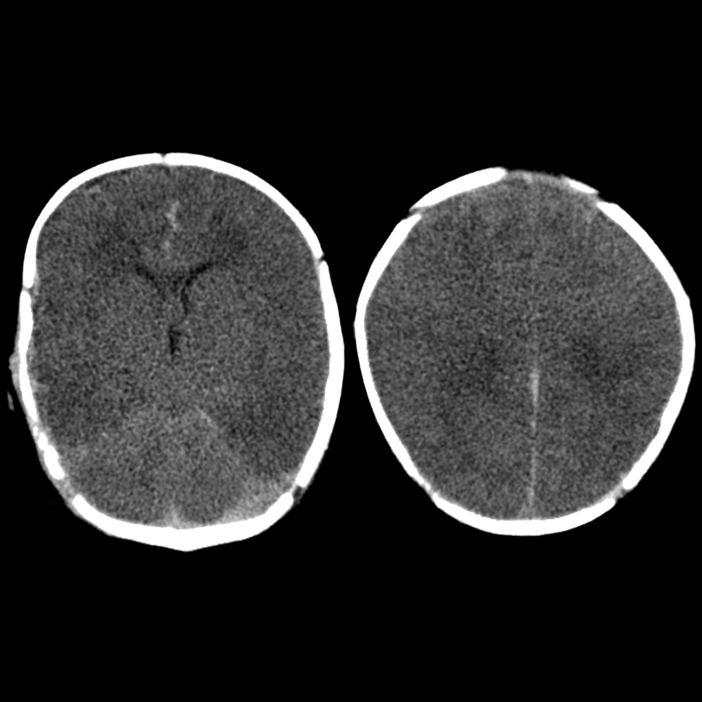 Image for question 148