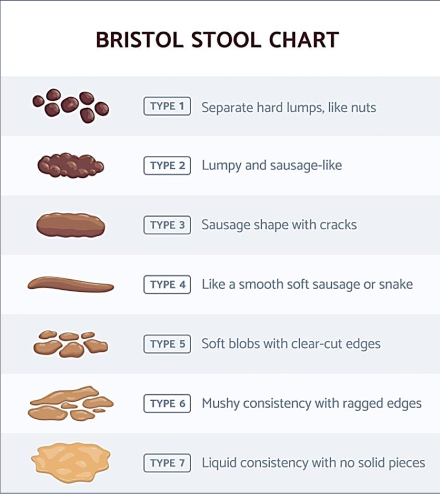 Bristol Stool Chart for IBS classification