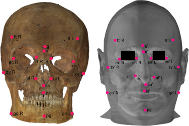 Craniofacial landmarks for forensic anthropology