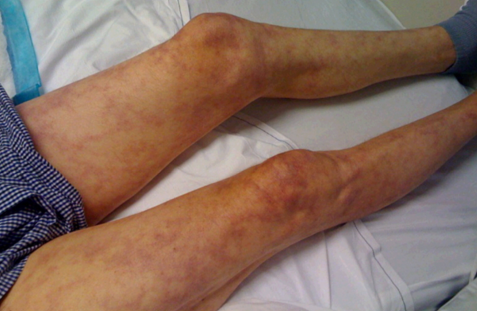 Image for question 419