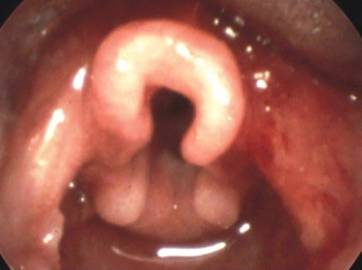 Image for question 233