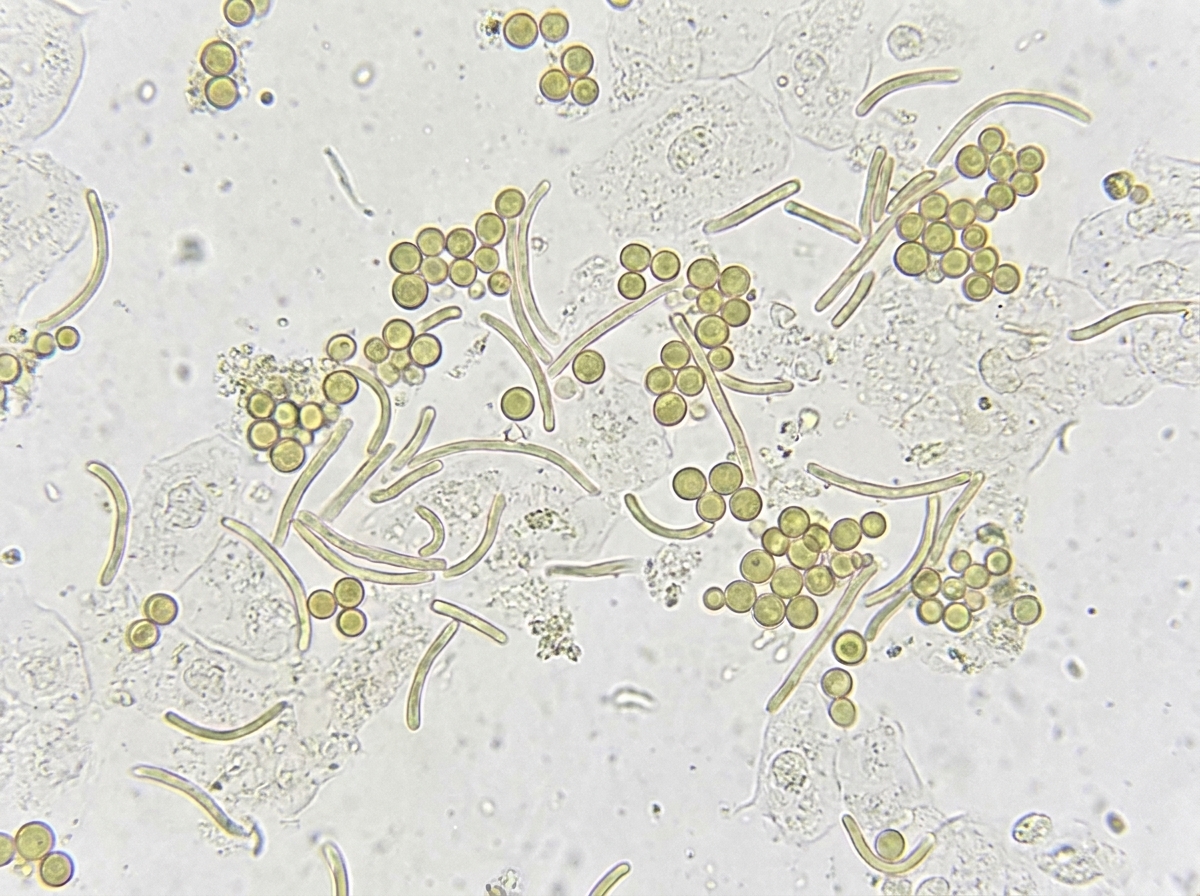 Image for question 57