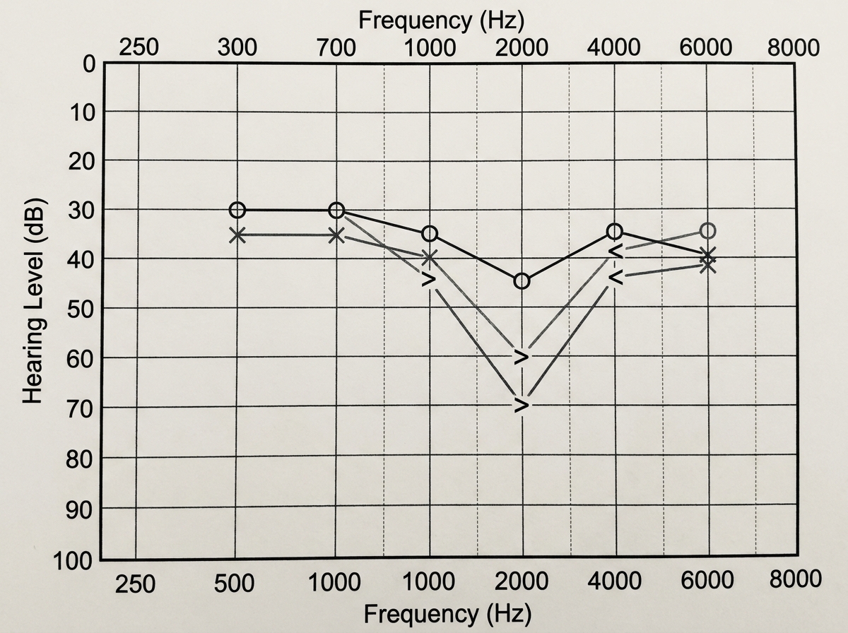 Image for question 175