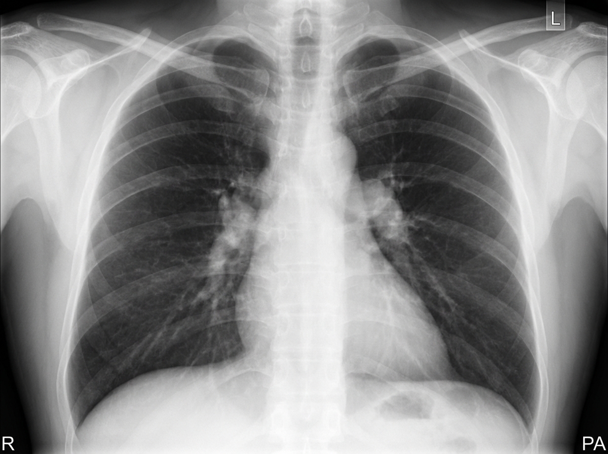 Image for question 468