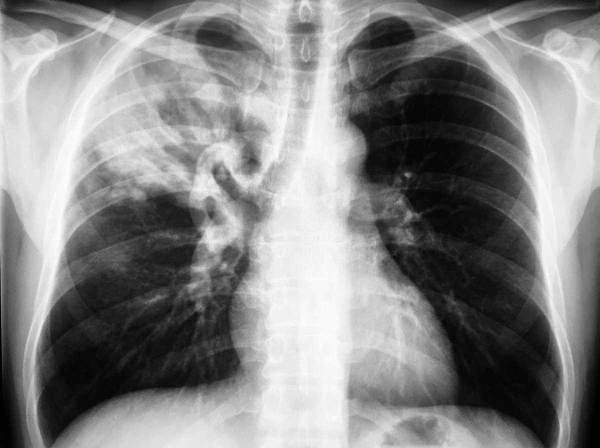 Image for question 3