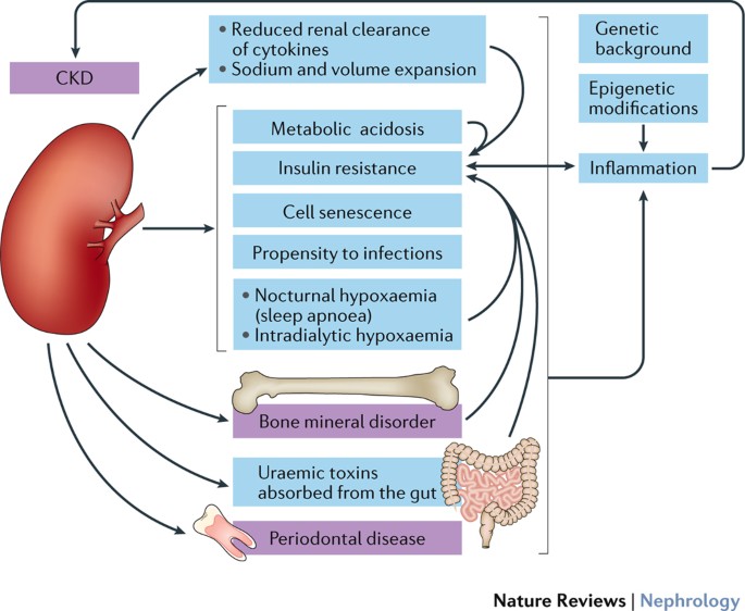 Systemic consequences of Chronic Kidney Disease (CKD)