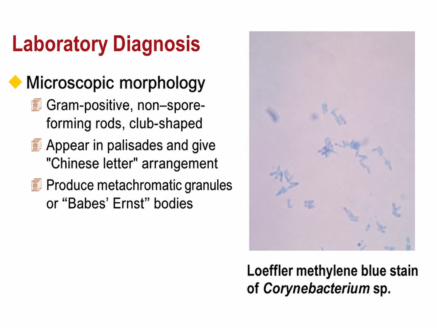 Corynebacterium sp. Loeffler methylene blue stain