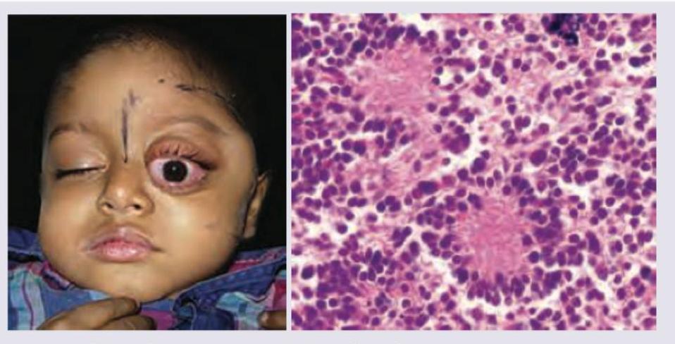 Image for question 153