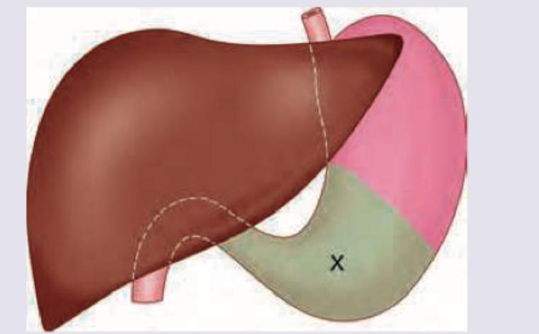 Image for question 706