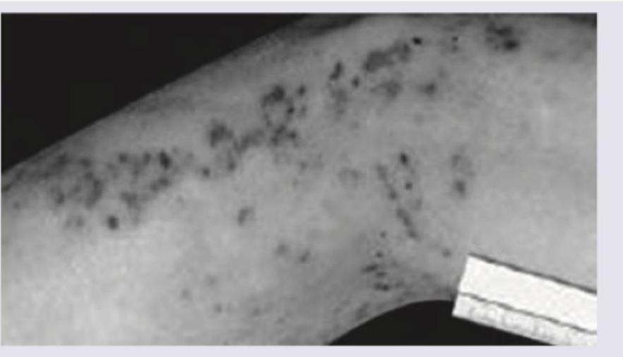 Image for question 515