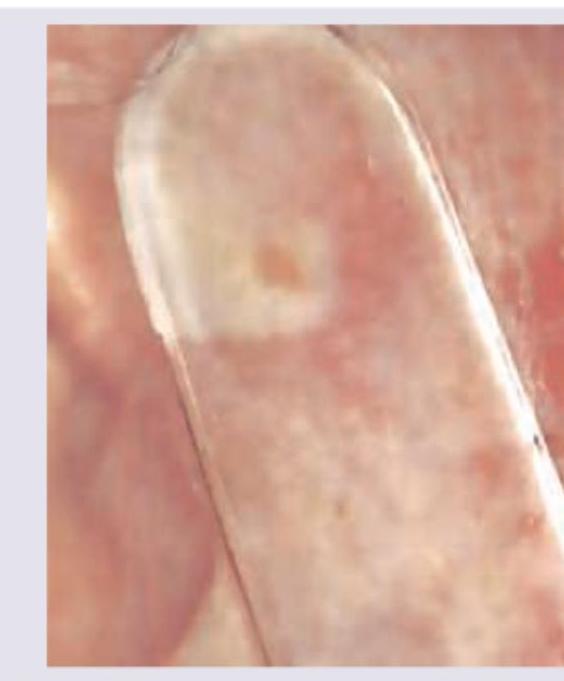 Image for question 174