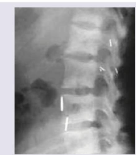 Image for question 120