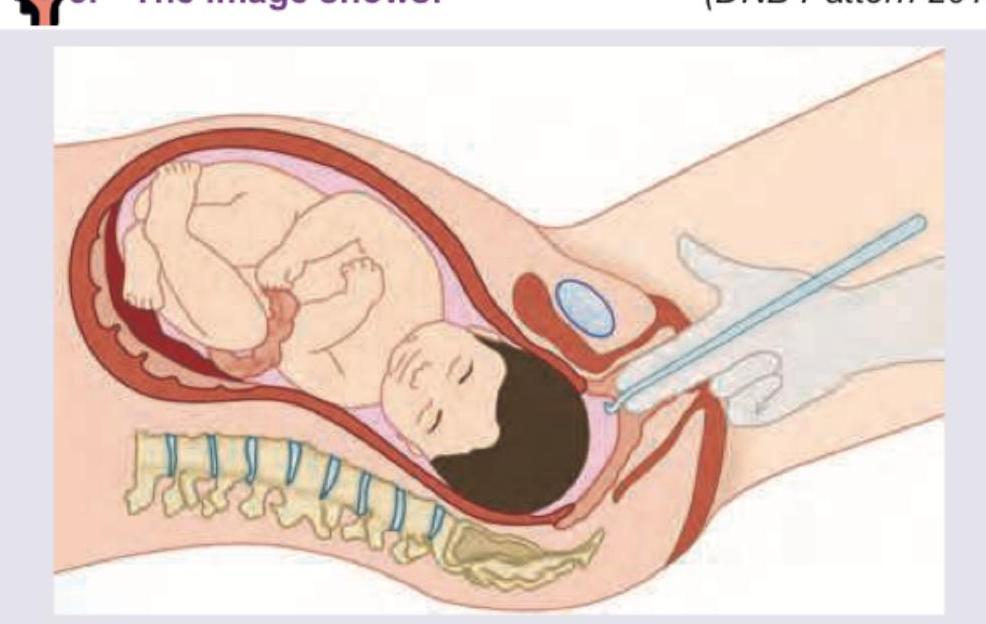 Image for question 8